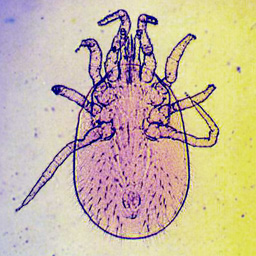 This is a dust mite